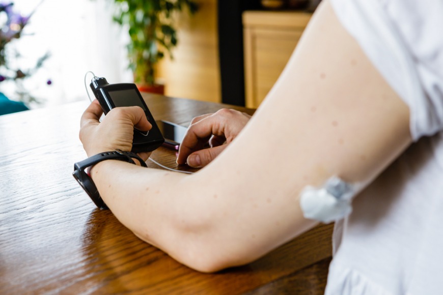 Insulin pump in Dubai Insulin pump in Dubai